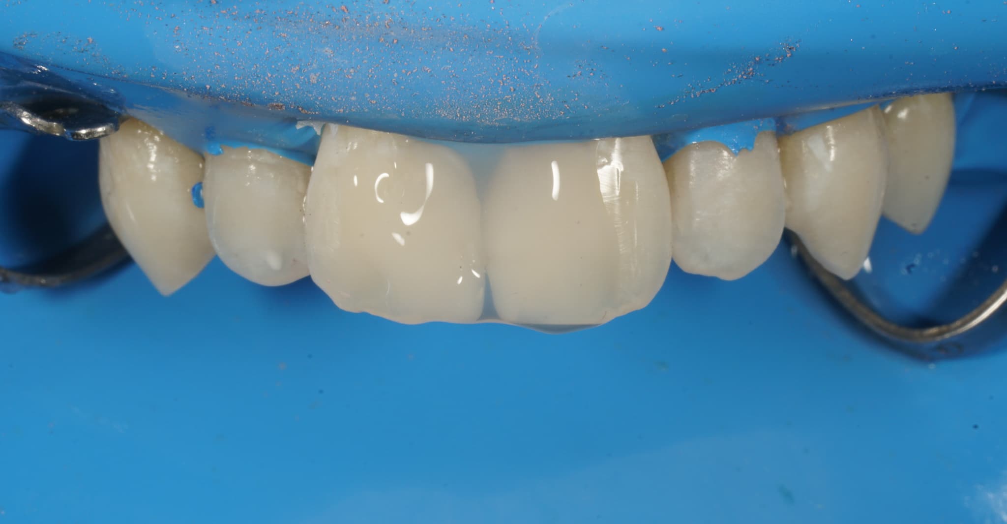 Fertige Restauration